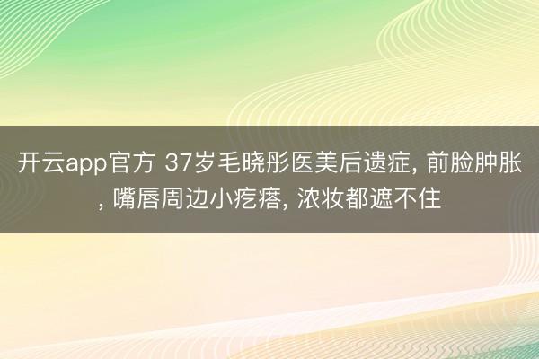 开云app官方 37岁毛晓彤医美后遗症, 前脸肿胀, 嘴唇周边小疙瘩, 浓妆都遮不住
